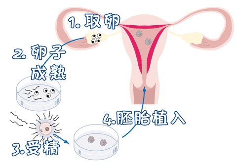 高齢初産